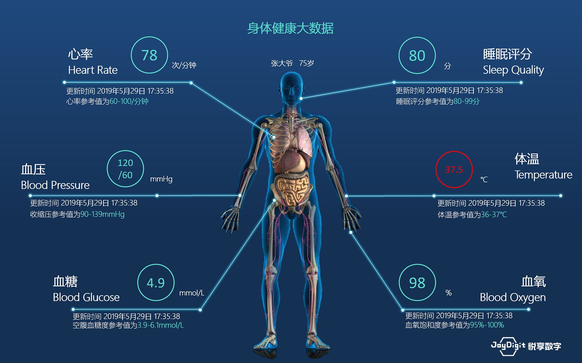 消費(fèi)日報(bào)：悅享數(shù)字推動新興技術(shù)與養(yǎng)老服務(wù)相結(jié)合，加快養(yǎng)老行業(yè)數(shù)字化轉(zhuǎn)型(圖9)